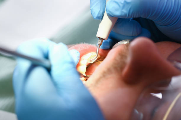 Best Emergency TMJ Treatment in Newnan, GA